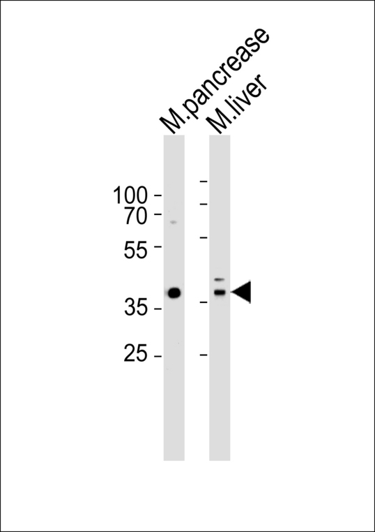 HMX3 Antibody - Western blot of lysates from mouse pancreas and mouse liver tissue (from left to right), using Hmx3 (Mouse C-term). Antibody was diluted at 1:1000 at each lane. A goat anti-rabbit IgG H&L (HRP) at 1:5000 dilution was used as the secondary antibody. Lysates at 35ug per lane.