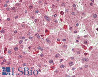 HNF1A / HNF1 Antibody - Human Liver: Formalin-Fixed, Paraffin-Embedded (FFPE)