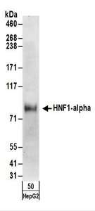 HNF1A / HNF1 Antibody - Detection of Human HNF1-alpha by Western Blot. Samples: Whole cell lysate (50 ug) from Hep G2 cells. Antibodies: Affinity purified rabbit anti-HNF1-alpha antibody used for WB at 0.1 ug/ml. Detection: Chemiluminescence with an exposure time of 30 seconds.