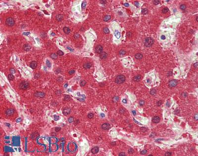 HNF1A / HNF1 Antibody - Human Liver: Formalin-Fixed, Paraffin-Embedded (FFPE)
