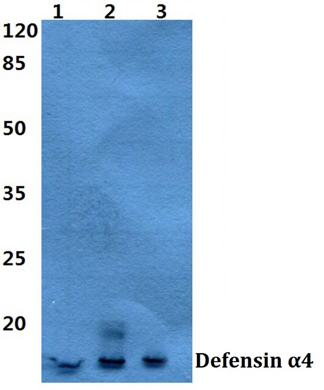 HNP-4 / DEFA4 Antibody - Western blot analysis of DEFA4 pAb at a 1:500 dilution.  Lane 1: MCF-7 cell lysate. Lane 2: Mouse spleen tissue extract. Lane 3: Rat spleen tissue extract.