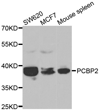 HNRNP-E2 / PCBP2 Antibody - Western blot analysis of extracts of various cell lines, using PCBP2 antibody.