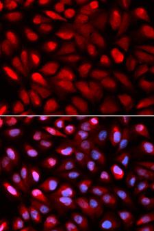 HNRNP-E2 / PCBP2 Antibody - Immunofluorescence analysis of U2OS cell using PCBP2 antibody. Blue: DAPI for nuclear staining.