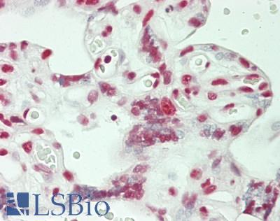 HnRNP U Antibody - Human Placenta: Formalin-Fixed, Paraffin-Embedded (FFPE)