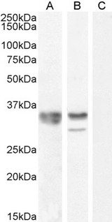 HNRNPA2B1 Antibody - HNRNPA2B1 antibody (0.1µg/ml) staining of NIH3T3 (A), (0.01ug/ml) nuclear NIH3T3 (B) lysate, + Peptide (C) (35µg protein in RIPA buffer). Detected by chemiluminescence.