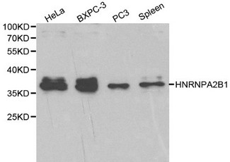HNRNPA2B1 Antibody - Western blot of HNRNPA2B1 pAb in extracts from Hela, BXPC-3, PC3 cells and mouse spleen tissue.