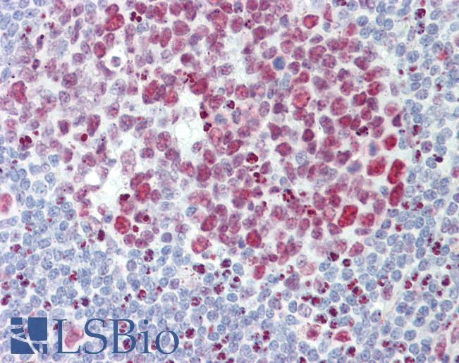 HNRNPAB Antibody - Anti-HNRNPAB antibody IHC staining of human tonsil. Immunohistochemistry of formalin-fixed, paraffin-embedded tissue after heat-induced antigen retrieval.