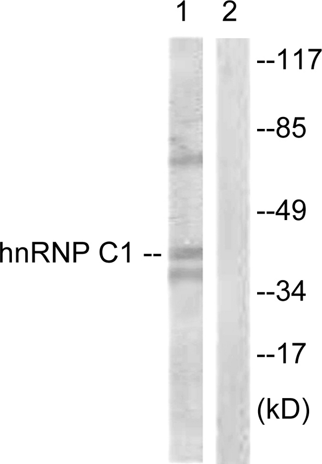 HNRNPC / HNRNP C Antibody - Western blot analysis of lysates from HUVEC cells, treated with EGF 200ng/ml 5', using hnRNP C1/2 Antibody. The lane on the right is blocked with the synthesized peptide.