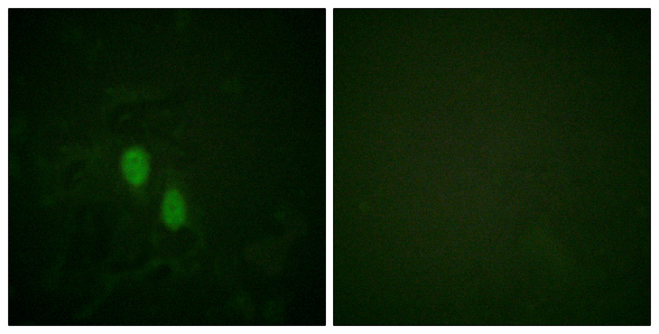 HNRNPD / AUF1 Antibody - Immunofluorescence analysis of HeLa cells, using hnRPD Antibody. The picture on the right is blocked with the synthesized peptide.