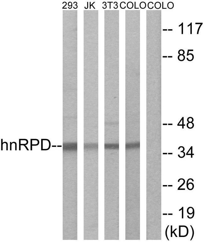 HNRNPD / AUF1 Antibody - Western blot analysis of lysates from 293, Jurkat, 3T3, and COLO205 cells, using hnRPD Antibody. The lane on the right is blocked with the synthesized peptide.