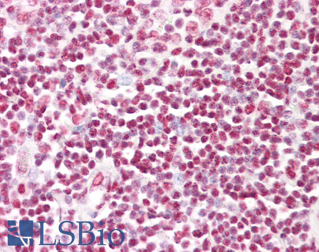 HNRNPD / AUF1 Antibody - Anti-HNRNPD / AUF1 antibody IHC of human tonsil. Immunohistochemistry of formalin-fixed, paraffin-embedded tissue after heat-induced antigen retrieval. Antibody dilution 1:100.