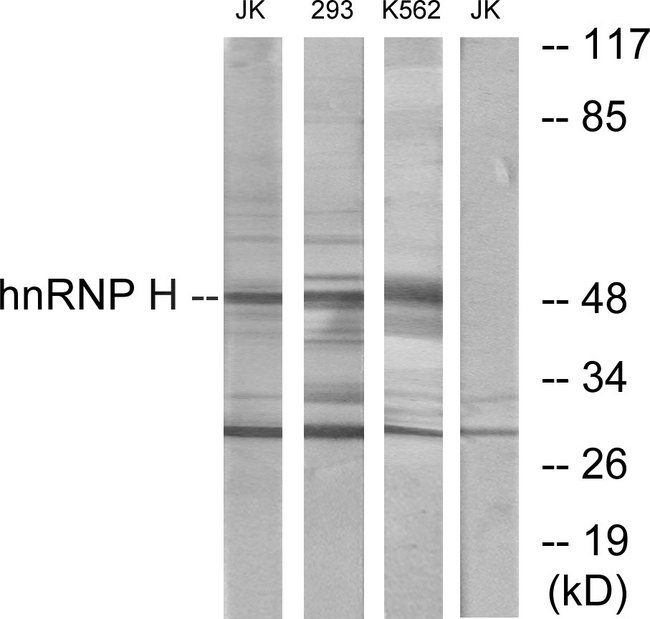 HNRNPH2 / hnRNP H2 Antibody - Western blot analysis of lysates from Jurkat, 293, and K562 cells, using hnRNP H Antibody. The lane on the right is blocked with the synthesized peptide.