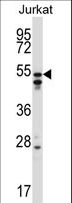 HNRNPH2 / hnRNP H2 Antibody - HNRNPH2 Antibody western blot of Jurkat cell line lysates (35 ug/lane). The HNRNPH2 antibody detected the HNRNPH2 protein (arrow).
