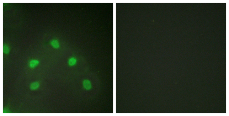 HNRNPL / hnRNP L Antibody - Immunofluorescence analysis of HeLa cells, using hnRNP L Antibody. The picture on the right is blocked with the synthesized peptide.