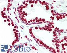 HNRPA1 / HnRNP A1 Antibody - Human Prostate: Formalin-Fixed, Paraffin-Embedded (FFPE)