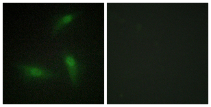 HNRPA1 / HnRNP A1 Antibody - Immunofluorescence analysis of HeLa cells, using hnRNP A1 Antibody. The picture on the right is blocked with the synthesized peptide.
