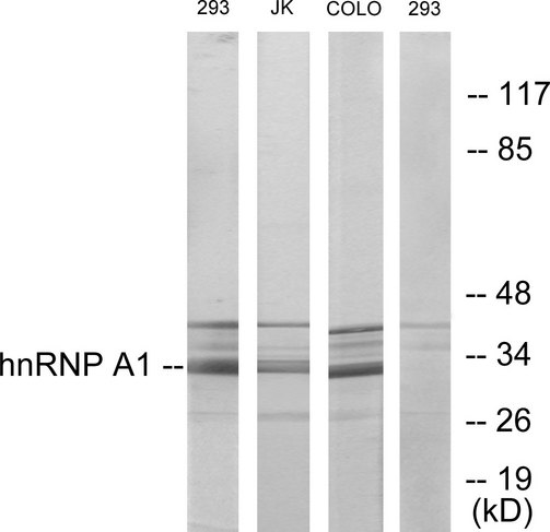HNRPA1 / HnRNP A1 Antibody - Western blot analysis of lysates from 293, Jurkat, and COLO205 cells, using hnRNP A1 Antibody. The lane on the right is blocked with the synthesized peptide.