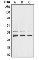 HNRPA1 / HnRNP A1 Antibody - Western blot analysis of hnRNP A1 expression in MCF7 (A); K562 (B); NIH3T3 (C) whole cell lysates.