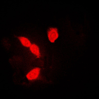 HNRPA1 / HnRNP A1 Antibody - Immunofluorescent analysis of hnRNP A1 staining in K562 cells. Formalin-fixed cells were permeabilized with 0.1% Triton X-100 in TBS for 5-10 minutes and blocked with 3% BSA-PBS for 30 minutes at room temperature. Cells were probed with the primary antibody in 3% BSA-PBS and incubated overnight at 4 C in a humidified chamber. Cells were washed with PBST and incubated with a DyLight 594-conjugated secondary antibody (red) in PBS at room temperature in the dark. DAPI was used to stain the cell nuclei (blue).