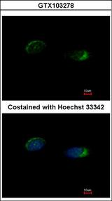 HOMER1 / Homer 1 Antibody - Immunofluorescence of methanol-fixed HeLa using Homer antibody at 1:500 dilution.