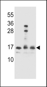 HOPX / HOP Antibody - HOPX Antibody western blot of Ramos,A2058,293 cell line lysates (35 ug/lane). The HOPX antibody detected the HOPX protein (arrow).