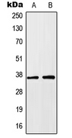 HOXA1 Antibody - Western blot analysis of HOXA1 expression in HEK293T (A); HeLa (B) whole cell lysates.