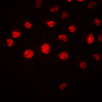 HOXA1 Antibody - Immunofluorescent analysis of HOXA1 staining in HeLa cells. Formalin-fixed cells were permeabilized with 0.1% Triton X-100 in TBS for 5-10 minutes and blocked with 3% BSA-PBS for 30 minutes at room temperature. Cells were probed with the primary antibody in 3% BSA-PBS and incubated overnight at 4 C in a humidified chamber. Cells were washed with PBST and incubated with a DyLight 594-conjugated secondary antibody (red) in PBS at room temperature in the dark. DAPI was used to stain the cell nuclei (blue).