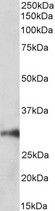 HOXA5 Antibody - Goat Anti-HOXA5 (aa157-168) Antibody (1µg/ml) staining of Pig Kidney lysate (35µg protein in RIPA buffer). Primary incubation was 1 hour. Detected by chemiluminescencence.