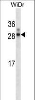 HOXA7 Antibody - Rat Hoxa7 Antibody western blot of WiDr cell line lysates (35 ug/lane). The Hoxa7 antibody detected the Hoxa7 protein (arrow).