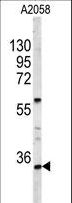 HOXA9 Antibody - Western blot of HOXA9 Antibody in A2058 cell line lysates (35 ug/lane). HOXA9 (arrow) was detected using the purified antibody.