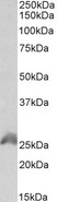 HOXB6 Antibody - HOXB6 antibody (1 ug/ml) staining of HEK293 lysate (35 ug protein in RIPA buffer). Primary incubation was 1 hour. Detected by chemiluminescence.