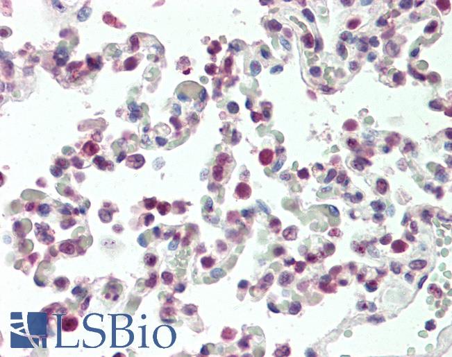 HOXB6 Antibody - Anti-HOXB6 antibody IHC staining of human lung. Immunohistochemistry of formalin-fixed, paraffin-embedded tissue after heat-induced antigen retrieval. Antibody concentration 5 ug/ml.
