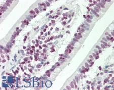 HOXC4 Antibody - Human Small Intestine: Formalin-Fixed, Paraffin-Embedded (FFPE)