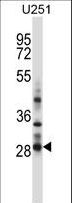 HOXC4 Antibody - HOXC4 Antibody western blot of U251 cell line lysates (35 ug/lane). The HOXC4 antibody detected the HOXC4 protein (arrow).