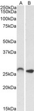 HOXC6 Antibody - HOXC6 antibody (0.01µg/ml) staining of Mouse (A) and Rat (B) Brain lysates (35µg protein in RIPA buffer). Detected by chemiluminescence.