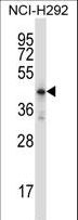 HOXD10 Antibody - Mouse Hoxd10 Antibody western blot of NCI-H292 cell line lysates (35 ug/lane). The Hoxd10 antibody detected the Hoxd10 protein (arrow).