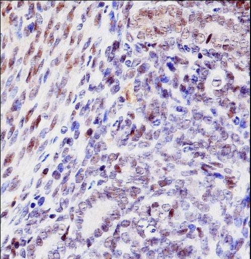 HOXD10 Antibody - Mouse Hoxd10 Antibody immunohistochemistry of formalin-fixed and paraffin-embedded mouse uterus tissue followed by peroxidase-conjugated secondary antibody and DAB staining.