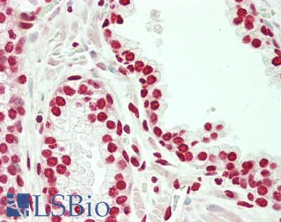 HOXD10 Antibody - Human Prostate: Formalin-Fixed, Paraffin-Embedded (FFPE)