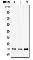 HOXD12 Antibody - Western blot analysis of HOXD12 expression in A549 (A); HUVEC (B); NIH3T3 (C) whole cell lysates.