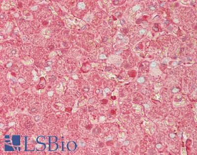 HP / Haptoglobin Antibody - Human Liver: Formalin-Fixed, Paraffin-Embedded (FFPE)