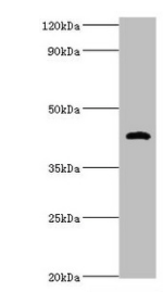 HP / Haptoglobin Antibody - Western blot All lanes: Haptoglobin antibody at 2µg/ml + Mouse stomach tissue Secondary Goat polyclonal to rabbit IgG at 1/10000 dilution Predicted band size: 46, 39 kDa Observed band size: 46 kDa
