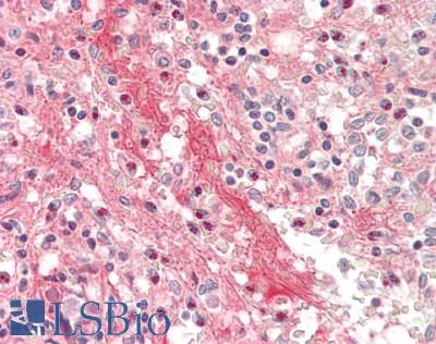 HP / Haptoglobin Antibody - Human Spleen: Formalin-Fixed, Paraffin-Embedded (FFPE)