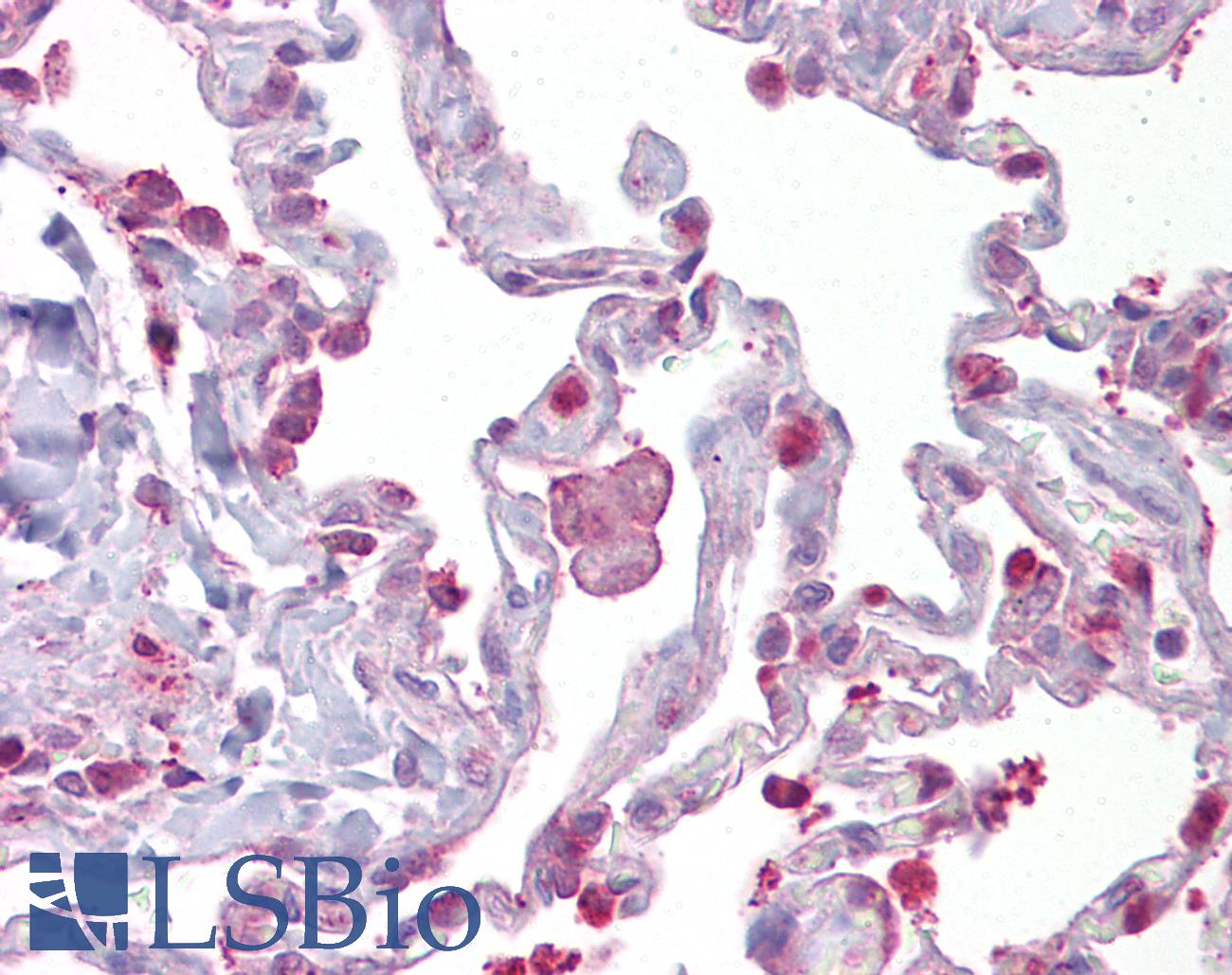 HPGDS Antibody - Anti-HPGDS / PGDS antibody IHC of human lung. Immunohistochemistry of formalin-fixed, paraffin-embedded tissue after heat-induced antigen retrieval. Antibody concentration 5 ug/ml.  This image was taken for the unconjugated form of this product. Other forms have not been tested.