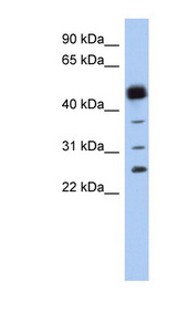 HPGDS Antibody - HPGDS / PGDS antibody Western blot of Fetal Spleen lysate. This image was taken for the unconjugated form of this product. Other forms have not been tested.