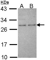 HPRT1 / HPRT Antibody - Sample (30 ug of whole cell lysate). A: Molt-4 , B: Raji. 12% SDS PAGE. HPRT1 / HPRT antibody diluted at 1:1000.