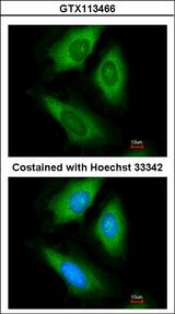 HPRT1 / HPRT Antibody - Immunofluorescence of paraformaldehyde-fixed HeLa using HPRT antibody at 1:200 dilution.