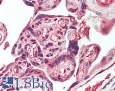 HPSE / Heparanase Antibody - Human Placenta: Formalin-Fixed, Paraffin-Embedded (FFPE)
