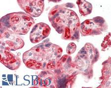 HPX / Hemopexin Antibody - Human Placenta: Formalin-Fixed, Paraffin-Embedded (FFPE)