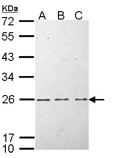 HRAS / H-Ras Antibody - Sample (30 ug of whole cell lysate). A: Hela, B: Hep G2 , C: Molt-4 . 12% SDS PAGE. HRAS / K-RAS antibody diluted at 1:1000.