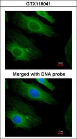 HRAS / H-Ras Antibody - Immunofluorescence of paraformaldehyde-fixed HeLa using H-Ras antibody at 1:200 dilution.